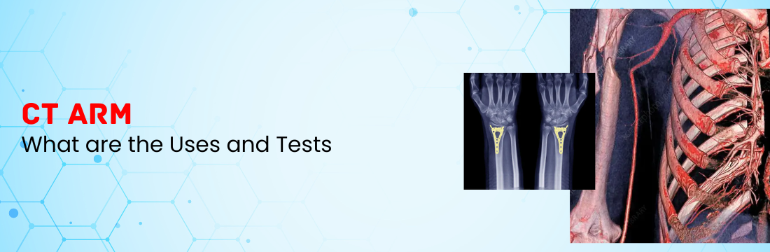 CT Arm: What Are the Uses?